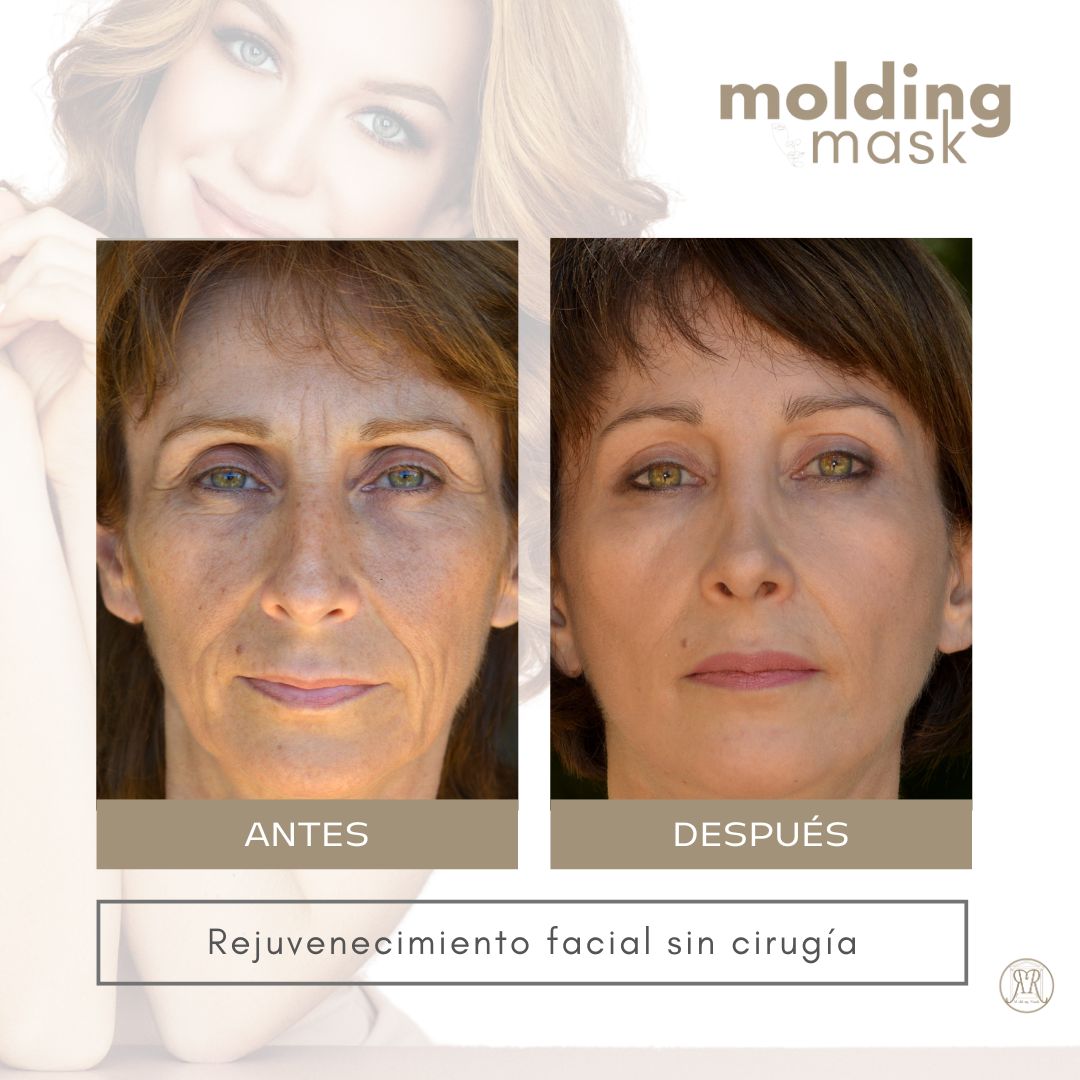 molding-mask