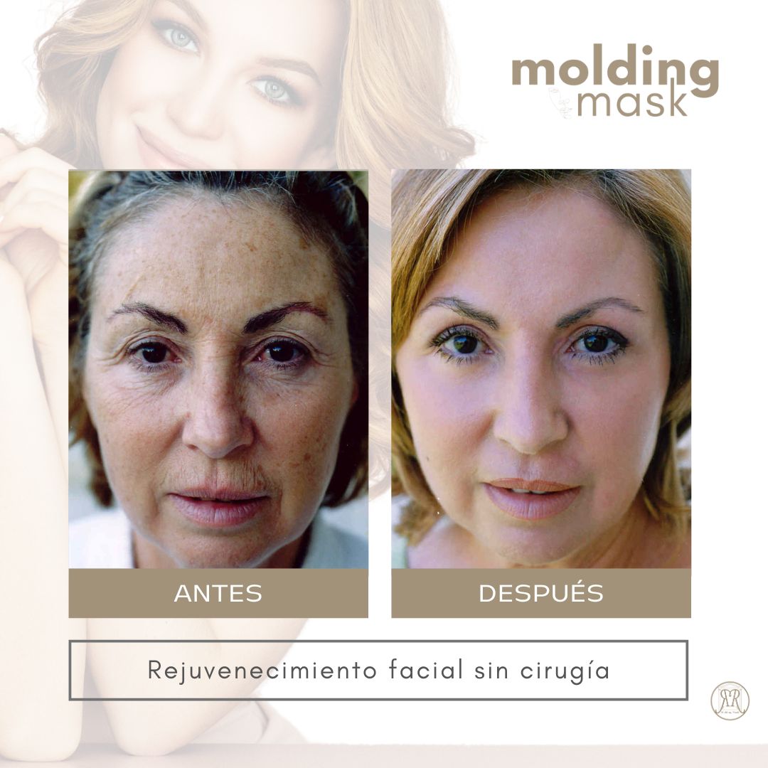 Molding-Mask