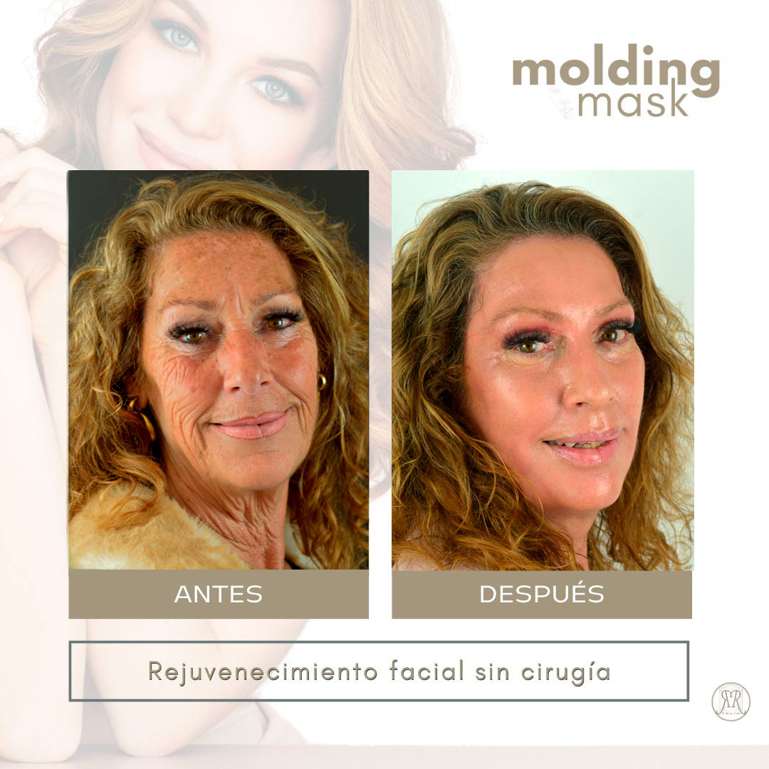 Historia-Molding-mask